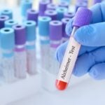 La FDA exige más controles a Biogen por riesgos en su fármaco para el Alzheimer Leqembi