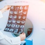 템퍼스AI, 1분기 실적 발표 후 주가 급등세···애널리스트, AI 기반 플랫폼 및 확대된 제약사 거래에 주목